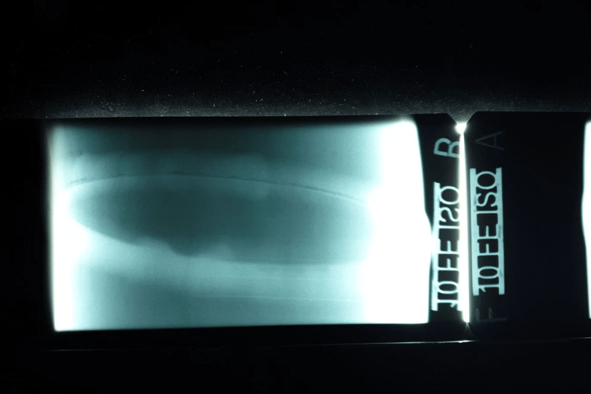 rt gammagraphie – zerstörungsfreie werkstoffprüfung – zfp münchen